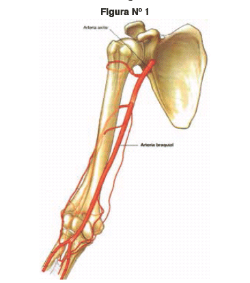 Bifurcaci n Alta De La Arteria Braquial humeral 