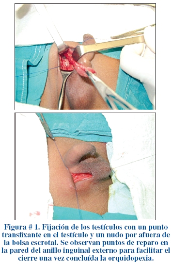 Aros testiculares sales