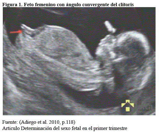 Test de sales sexo del bebe